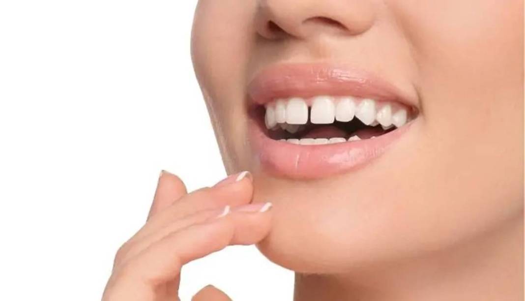 Bu fiziksel özelliklere sahipseniz şanslı azınlıktasınız! Doğuştan geliyor ve nadir bulunuyor 9